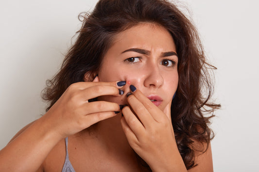 Understanding and Managing Acne